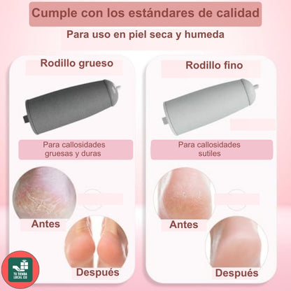 REMOVEDOR DE CALLOS PEDIGLAM ELECTRICO RECARGABLE + ENVÍO GRATIS