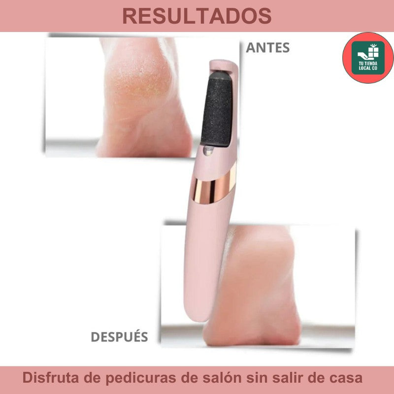 REMOVEDOR DE CALLOS PEDIGLAM ELECTRICO RECARGABLE + ENVÍO GRATIS