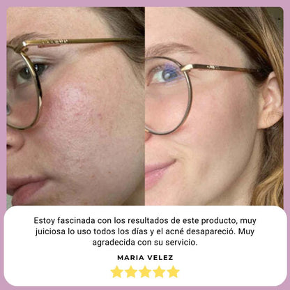 EN OFERTA | Masajeador lifting profesional Vitaluxe SKINCARE reafirmante antienvejecimiento en el cuidado de la piel |